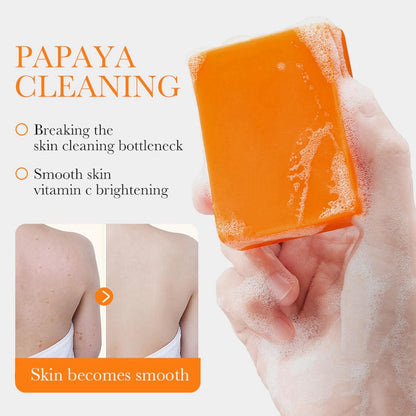 Kojic Acid Soap For Hyperpigmentation